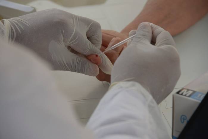 Saúde do DF recebe mais de 38 mil testes rápidos para dengue
