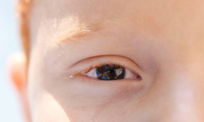 Erros de refração são principal causa de deficiência visual infantil