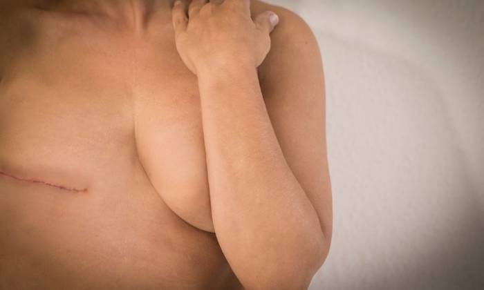 Pacientes recebem procedimentos de reconstrução mamária gratuitos em Brasília