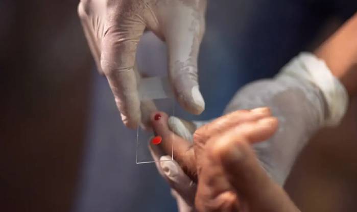 SUS começa a usar novo tratamento contra a malária em crianças