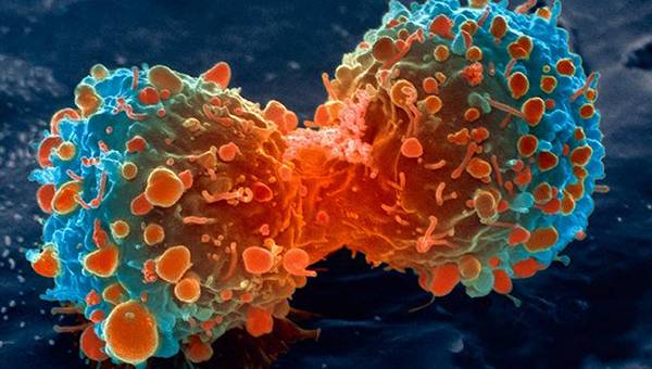 Oncologista  alerta para prevenção no Dia Mundial de Combate ao Câncer
